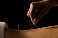 Acupuncture Training Courses 722991 Image 4